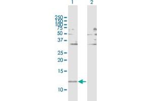 Western Blot analysis of FABP1 expression in transfected 293T cell line by FABP1 MaxPab polyclonal antibody. (FABP1 antibody  (AA 1-127))