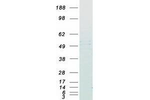 Validation with Western Blot (FNTB Protein (Myc-DYKDDDDK Tag))