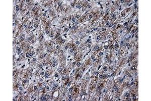 Immunohistochemical staining of paraffin-embedded pancreas tissue using anti-PLEKmouse monoclonal antibody. (Pleckstrin antibody)