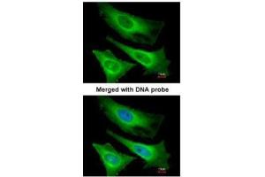 ICC/IF Image Immunofluorescence analysis of paraformaldehyde-fixed HeLa, using TNNI3K, antibody at 1:200 dilution. (TNNI3K antibody)