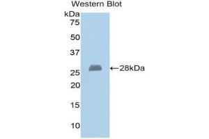 Western Blotting (WB) image for anti-Exostosin 1 (EXT1) (AA 334-549) antibody (ABIN1176519) (EXT1 antibody  (AA 334-549))