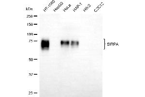 Western blotting analysis using SIRPA antibody (ABIN7800350).