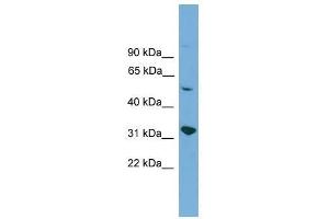 YIPF2 antibody used at 0. (YIPF2 antibody  (Middle Region))