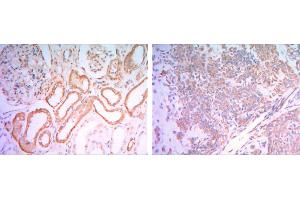 Immunohistochemical analysis of paraffin-embedded human salivary gland tissues (left) and kidney tissues (right) using HK1 mouse mAb with DAB staining. (Hexokinase 1 antibody)