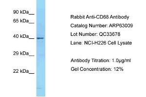Western Blotting (WB) image for anti-CD68 Molecule (CD68) (N-Term) antibody (ABIN2789336) (CD68 antibody  (N-Term))