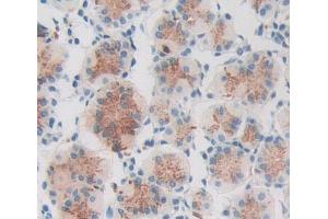Used in DAB staining on fromalin fixed paraffin- embedded stomach tissue (PCCA antibody  (AA 580-728))