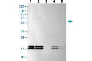 Western blot analysis of Lane 1: RT-4, Lane 2: U-251 MG, Lane 3: Human Plasma, Lane 4: Liver, Lane 5: Tonsil with NME1-NME2 polyclonal antibody  at 1:100-1:250 dilution. (NME1 antibody)