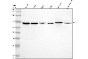 anti-Suppressor of Cancer Cell Invasion (SCAI) (AA 1-549) antibody