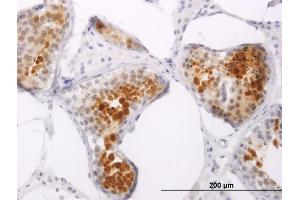 Immunoperoxidase of monoclonal antibody to PPP1R2P3 on formalin-fixed paraffin-embedded human testis. (PPP1R2P3 antibody  (AA 1-205))