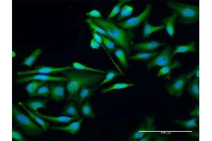 Immunofluorescence of purified MaxPab antibody to WTIP on HeLa cell. (WTIP antibody  (AA 1-430))