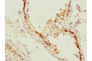 Immunohistochemistry of paraffin-embedded human testis tissue using ABIN7151071 at dilution of 1:100 (MID1 antibody  (AA 478-667))