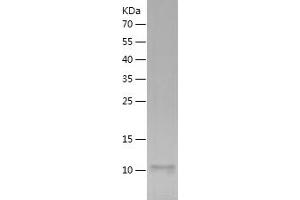 Western Blotting (WB) image for Chemokine (C-X-C Motif) Ligand 1 (Melanoma Growth Stimulating Activity, Alpha) (CXCL1) (AA 35-107) protein (His tag) (ABIN7122318)