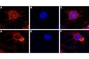 Expression of TRPV4 in rat DRG primary culture - Immunocytochemical staining of paraformaldehyde-fixed and permeabilized rat dorsal root ganglion (DRG) primary culture. (TRPV4 antibody  (C-Term, Intracellular))