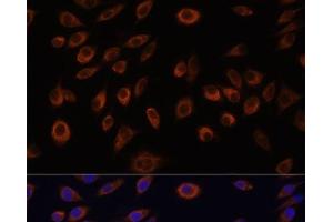 Immunofluorescence analysis of L929 cells using NTPCR Polyclonal Antibody at dilution of 1:100. (C1orf57 antibody)