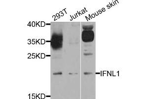 Western blot analysis of extract of various cells, using IFNL1 antibody. (IL29 antibody)