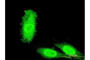 Immunofluorescence of monoclonal antibody to IRAK3 on HeLa cell. (IRAK3 antibody  (AA 497-596))
