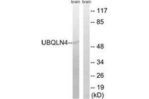 Western blot analysis of extracts from mouse brain cells, using UBQLN4 Antibody. (UBQLN4 antibody  (AA 201-250))
