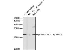 Western blot analysis of extracts of various cell lines, using p16-ARC//p16-ARC// antibody (ABIN6128967, ABIN6137131, ABIN6137132 and ABIN6224672) at 1:1000 dilution.