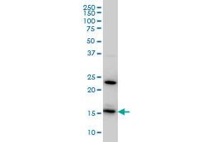 RPS17 monoclonal antibody (M01), clone 2C7 Western Blot analysis of RPS17 expression in HeLa . (RPS17 antibody  (AA 36-135))