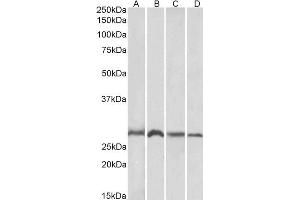 ABIN184675 (1µg/ml) staining of Mouse (A, C) and Rat (B, D) Brain (A, B) and Liver (C, D) lysates (35µg protein in RIPA buffer). (SIAH1 antibody  (N-Term))