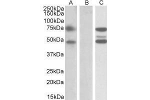 HEK293 lysate (10ug protein in RIPA buffer) overexpressing Human ASNSD1 with DYKDDDDK tag probed with ABIN5539631 (1ug/ml) in Lane A and probed with anti-DYKDDDDK Tag (1/10000) in lane C. (ASNSD1 antibody  (Internal Region))