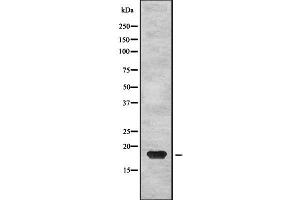 Western blot analysis of PTP4A2 using HepG2 whole cell lysates (PTP4A2 antibody  (Internal Region))