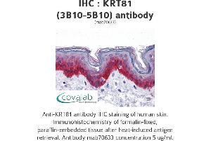 Image no. 1 for anti-Keratin 81 (KRT81) (AA 1-203), (full length) antibody (ABIN1723490) (KRT81 antibody  (full length))