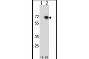 Western blot analysis of BLNK (arrow) using rabbit polyclonal BLNK Antibody (N-term) (ABIN657356 and ABIN2846406). (B-Cell Linker antibody  (N-Term))