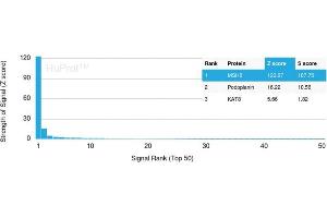 Analysis of Protein Array containing >19,000 full-length human proteins using MSH6 Mouse Monoclonal Antibody (MSH6/3091) Z- and S- Score: The Z-score represents the strength of a signal that a monoclonal antibody (MAb) (in combination with a fluorescently-tagged anti-IgG secondary antibody) produces when binding to a particular protein on the HuProtTM array. (MSH6 antibody  (AA 374-540))