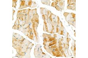 Immunohistochemistry of paraffin embedded rat skeletal muscle using Sarcomeric α Actinin (ABIN7075510) at dilution of 1:1000 (200x lens) (Sarcomeric alpha Actinin antibody)