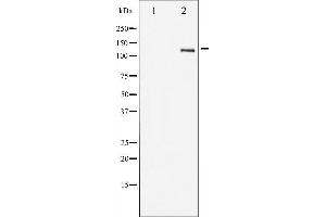 Western blot analysis of HER2 expression in 293 whole cell lysates,The lane on the left is treated with the antigen-specific peptide. (ErbB2/Her2 antibody  (C-Term))