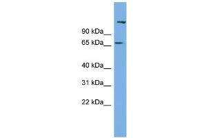 WB Suggested Anti-C12orf4 Antibody Titration: 0. (C12orf4 antibody  (N-Term))