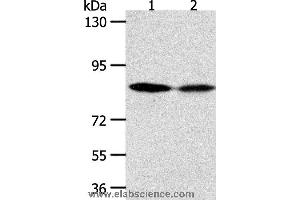 Western blot analysis of Hela and SKOV3 cell, using ADAM11 Polyclonal Antibody at dilution of 1:500 (ADAM11 antibody)