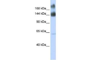 Kinectin 1 antibody used at 1 ug/ml to detect target protein. (KTN1 antibody)