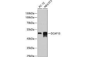 Western blot analysis of extracts of various cell lines, using DC antibody (ABIN6130928, ABIN6139428, ABIN6139429 and ABIN6217129) at 1:3000 dilution. (DCAF13 antibody  (AA 298-597))