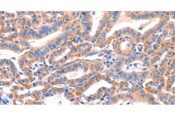 AP1B1 antibody