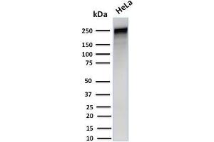 Western Blot Analysis of Human HeLa cell lysate using Spectrin alpha 1 Mouse Monoclonal Antibody (SPTA1/1832). (SPTA1 antibody  (AA 356-475))