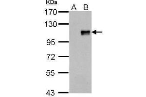 WB Image FOXM1 antibody detects FOXM1 protein by Western blot analysis. (FOXM1 antibody  (N-Term))