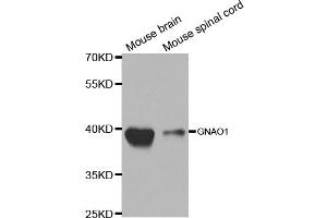 Western blot analysis of extracts of various cell lines, using GNAO1 antibody. (GNAO1 antibody)