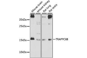 Western blot analysis of extracts of various cell lines, using TRAPPC6B antibody (ABIN6293632) at 1:1000 dilution.