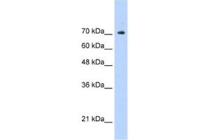 Western Blotting (WB) image for anti-Signal Transducer and Activator of Transcription 1, 91kDa (STAT1) antibody (ABIN2461817)