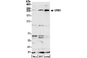 anti-URB1 Ribosome Biogenesis 1 Homolog (URB1) (AA 2221-2271) antibody
