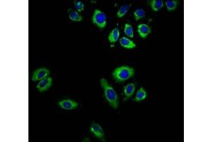 Immunofluorescence staining of A549 cells with ABIN7164493 at 1:166, counter-stained with DAPI.