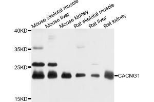 Western blot analysis of extracts of various cell lines, using CACNG1 antibody (ABIN4903103) at 1:1000 dilution. (CACNG1 antibody)