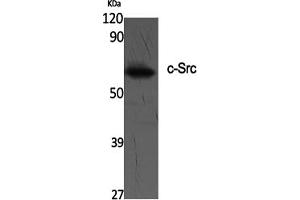 Western Blotting (WB) image for anti-Proto-oncogene tyrosine-protein kinase Src (Src) (Tyr419) antibody (ABIN5961533) (Src antibody  (Tyr419))