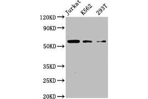 Western Blot Positive WB detected in: Jurkat whole cell lysate, K562 whole cell lysate, 293T whole cell lysate All lanes: CFLAR antibody at 4 μg/mL Secondary Goat polyclonal to rabbit IgG at 1/50000 dilution Predicted band size: 56, 26, 42, 28, 52, 51, 40, 31, 35, 53, 34, 24, 50, 45 kDa Observed band size: 56 kDa (FLIP antibody  (AA 1-250))