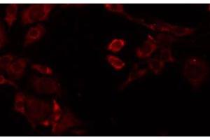 ABIN6277898 staining Hela by IF/ICC. (Renin antibody  (Internal Region))