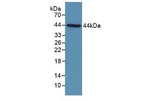 Detection of Recombinant C4d, Human using Polyclonal Antibody to Complement Component 4d (C4d)