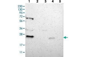 Western blot analysis of Lane 1: RT-4, Lane 2: Human Plasma, Lane 3: U-251 MG, Lane 4: Liver, Lane 5: Tonsil with PRRG4 polyclonal antibody . (PRRG4 antibody)