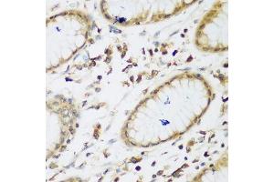 Immunohistochemistry of paraffin-embedded human gastric using UBE3A antibody. (ube3a antibody  (AA 300-590))